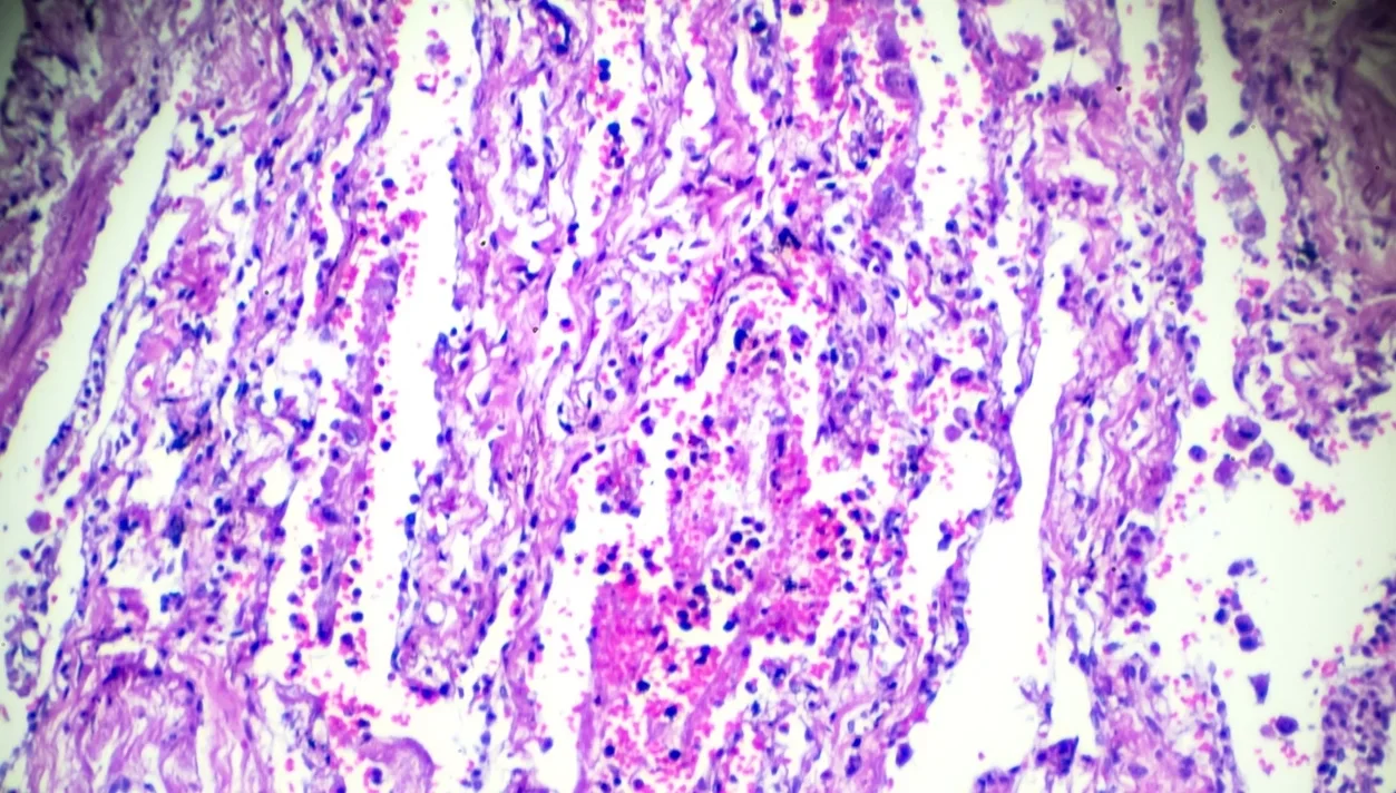 La red de Patología Digital más grande de Europa