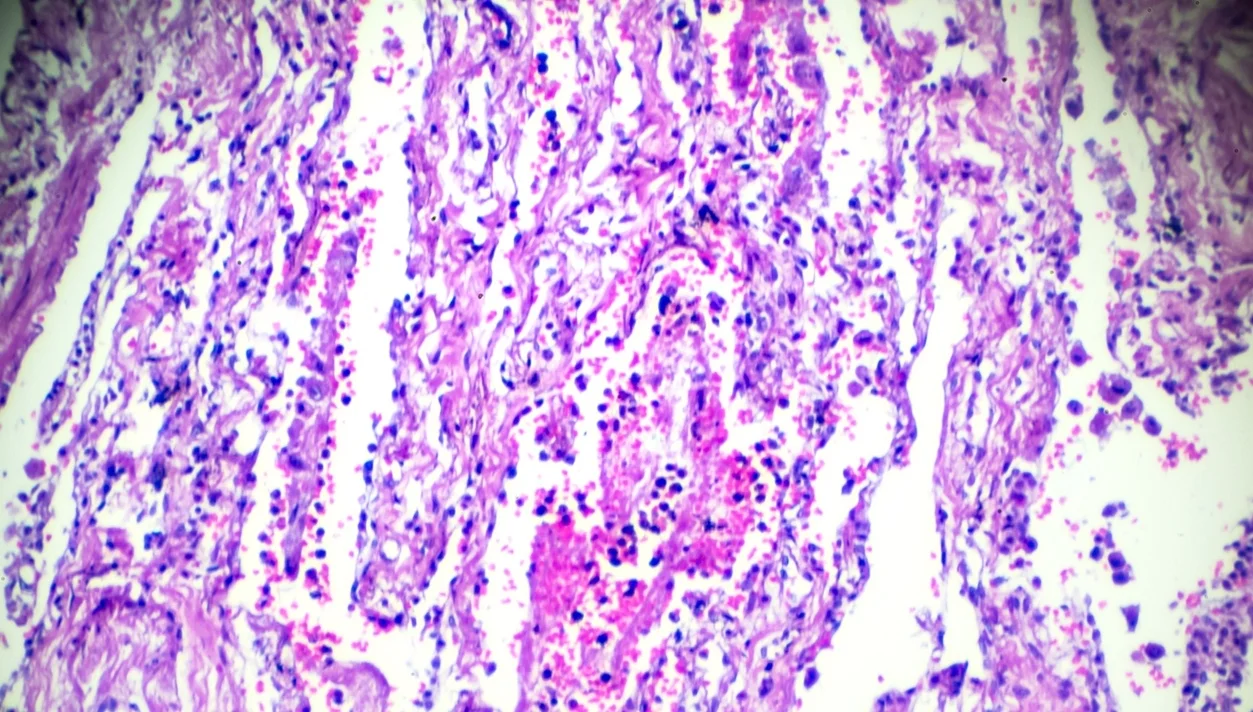 Anatomía Patológica